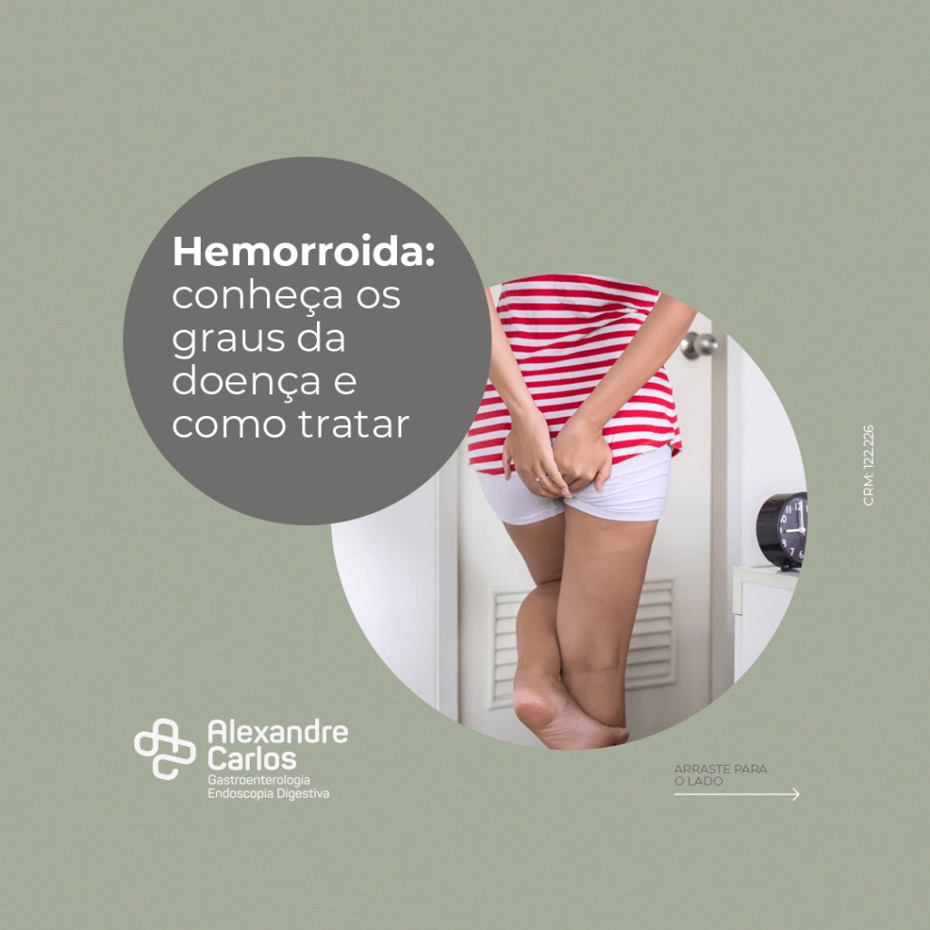 Hemorroida: Conheça Os Graus Da Doença E Como Tratar - Dr. Alexandre Carlos